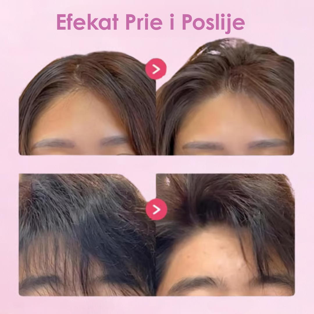 Šnale za Pufnastu Kosu sa 3 i 6 Zuba - SET od 2