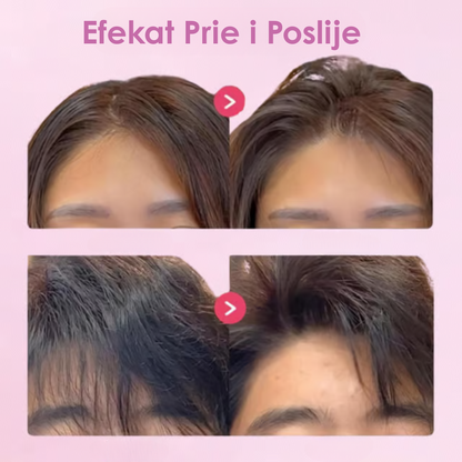 Šnale za Pufnastu Kosu sa 3 i 6 Zuba - SET od 2