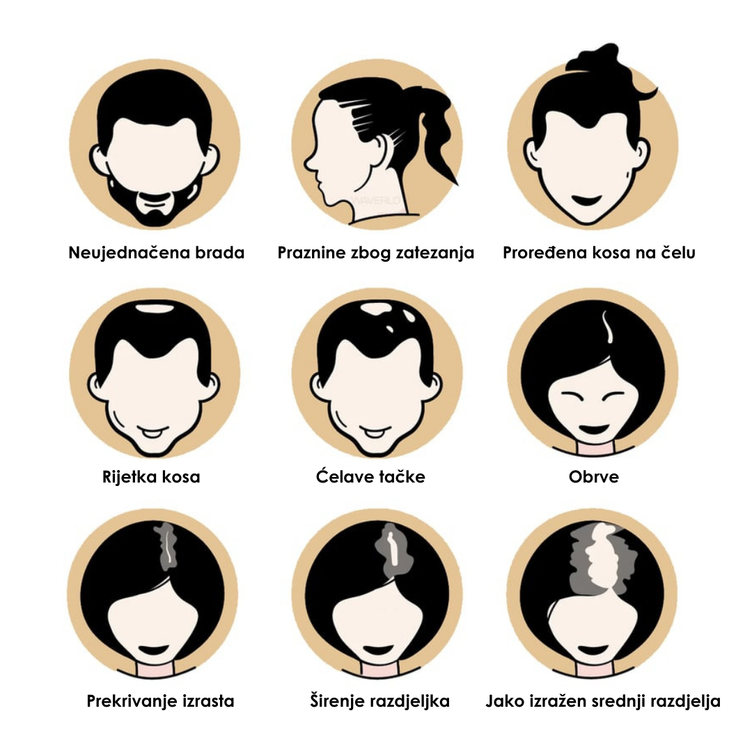 Nordik Hair™ - Puder za Prekrivanje Izrasta
