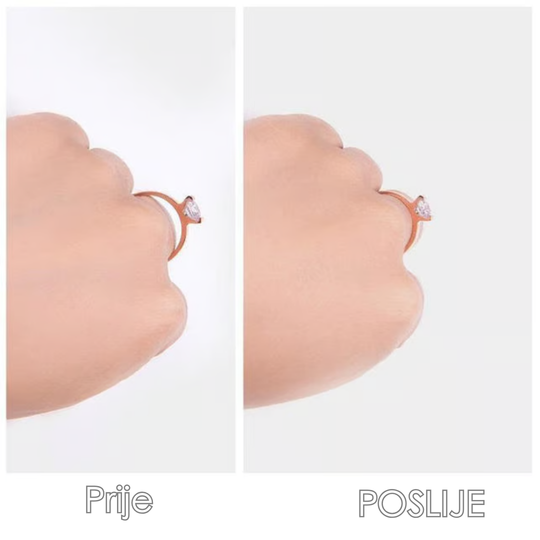 Set Za Prilagođavanje Veličine Prstenja