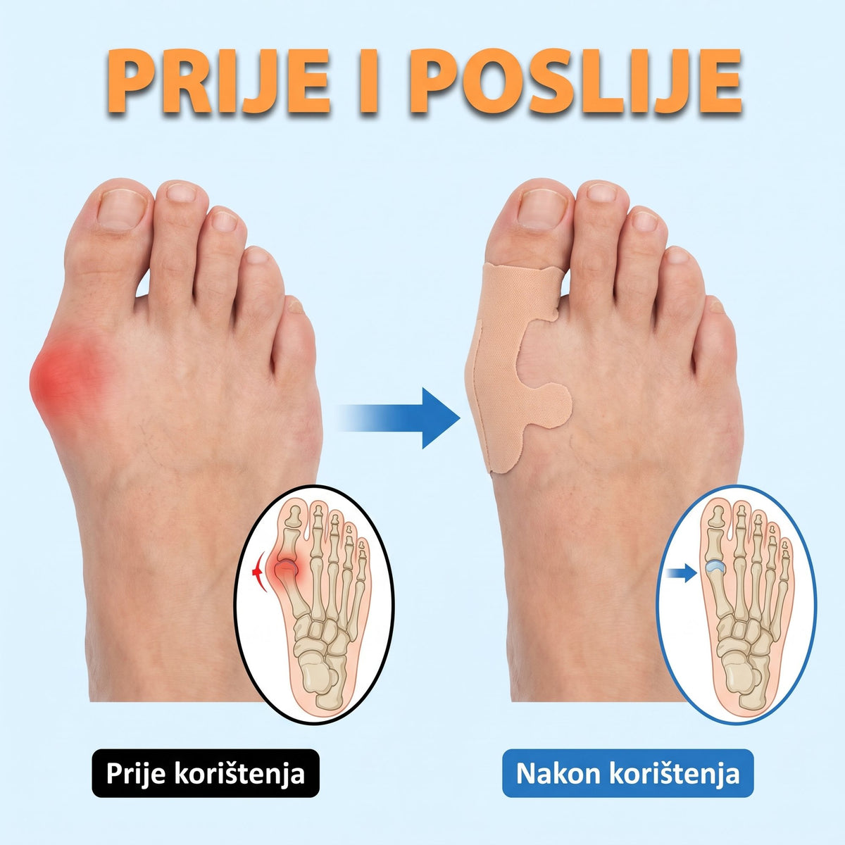 Traka za čukljeve — udobna kineziološka traka, elastična, hipoalergena - SET OD 20