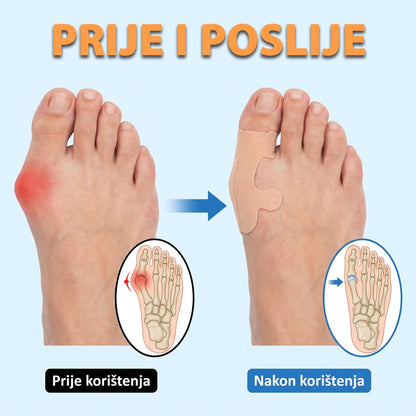 Traka za čukljeve — udobna kineziološka traka, elastična, hipoalergena - SET OD 20